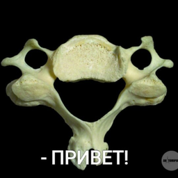 Позвонок. Позвонок Вертебра. Второй шейный позвонок Arcus vertebrae. Позвонок кость. Шейный позвонок кость.