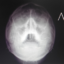 MicroBiologinya