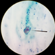 ������ ������������ metaplazia