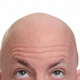 ������ ������������ BaldBob