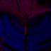 obsessionsturm