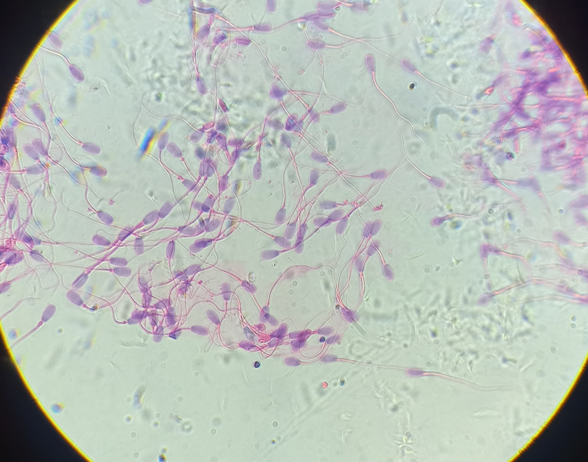 Как выглядит сперма под микроскопом | Пикабу