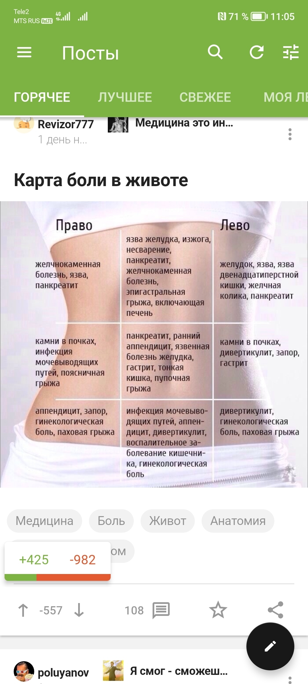 Карта боли в животе | Пикабу