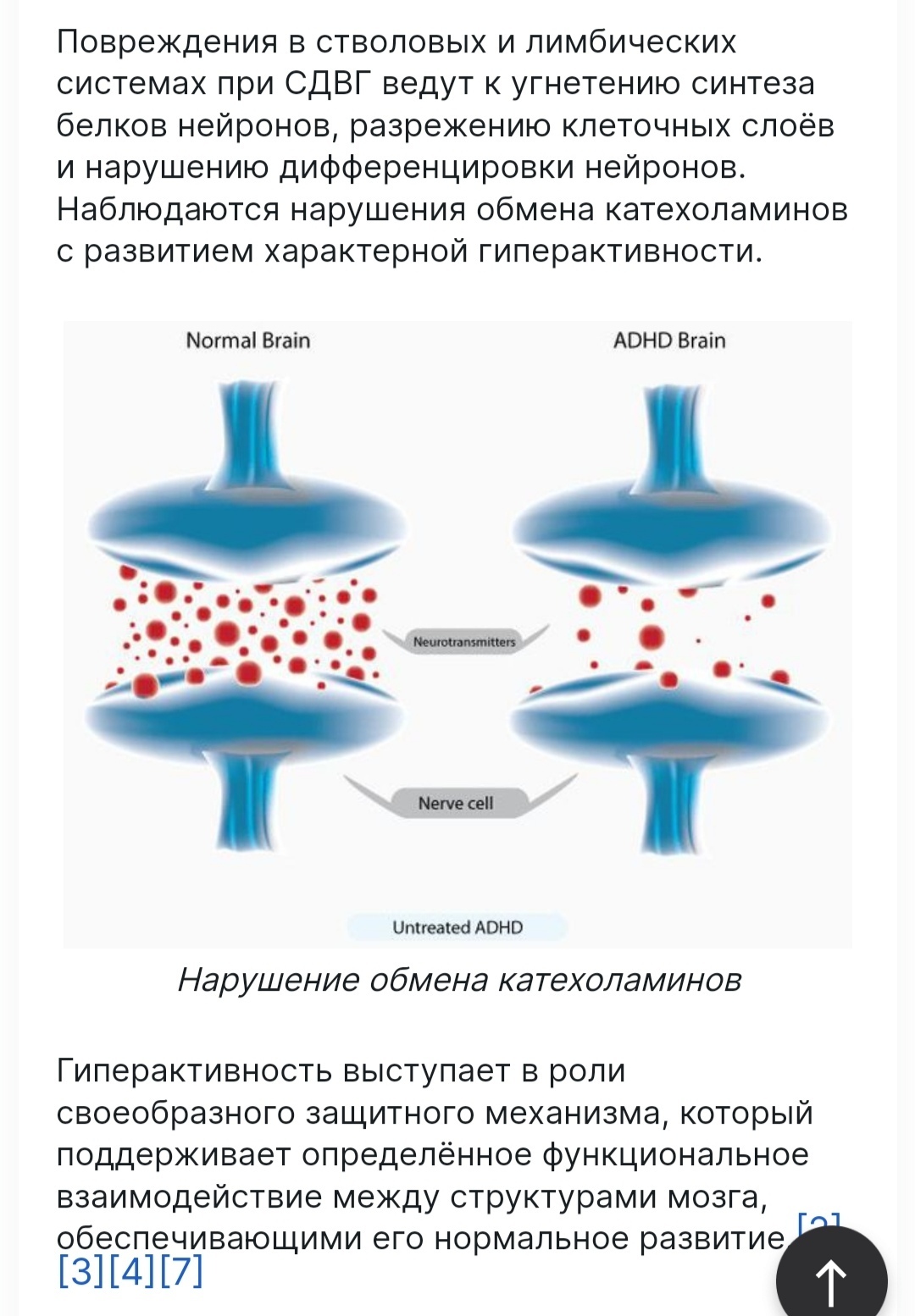 Как живут люди с СДВГ | Пикабу