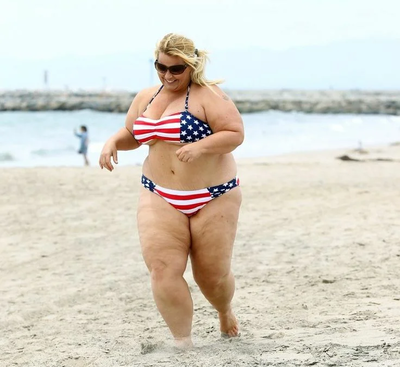 Ожоги от португальского кораблика фото