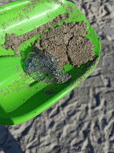 Ожоги от португальского кораблика фото