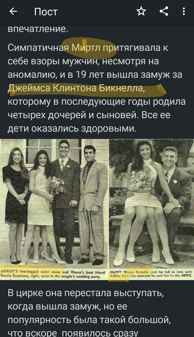 Девушка с двумя парами ног миф или реальность. Смотреть фото Девушка с двумя парами ног миф или реальность. Смотреть картинку Девушка с двумя парами ног миф или реальность. Картинка про Девушка с двумя парами ног миф или реальность. Фото Девушка с двумя парами ног миф или реальность