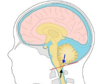 �������� ��������-����� 1 ����