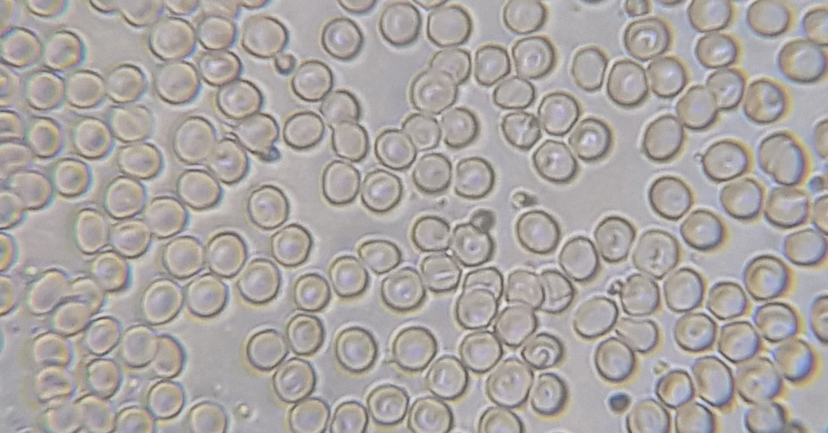 Фото под микроскопом клеток крови