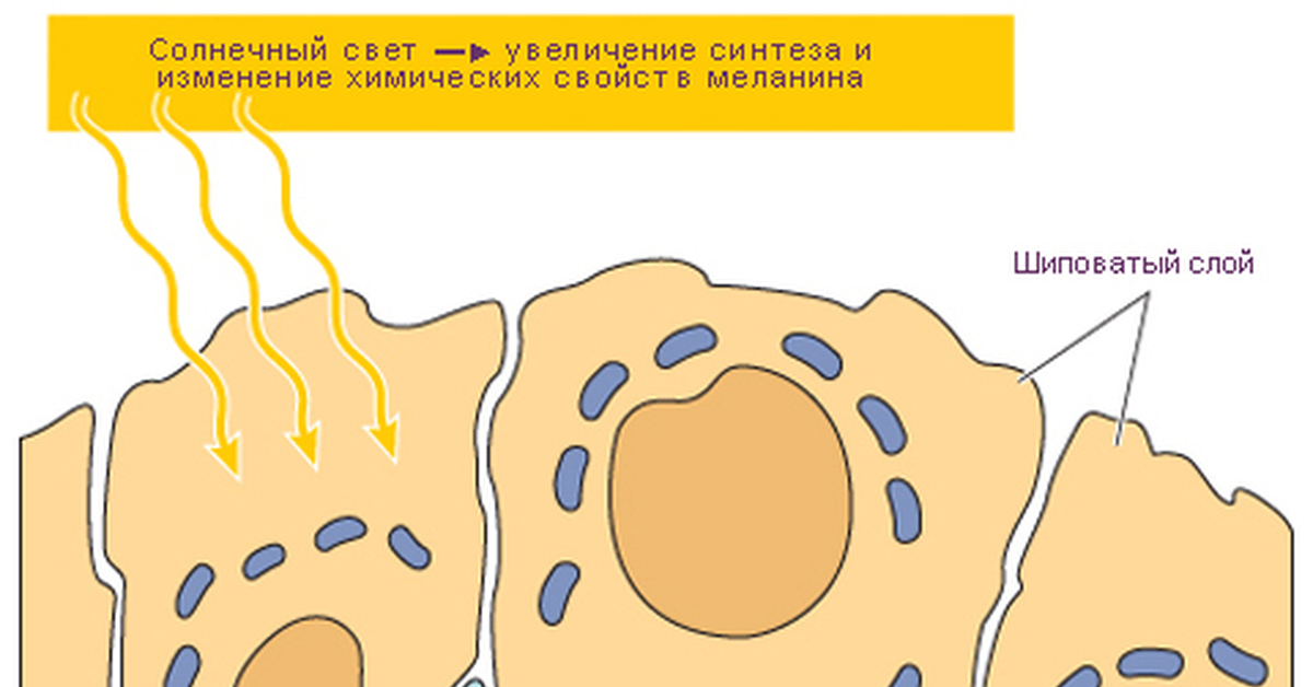 Как уберечься от меланомы Как уберечься от меланомы thumbnail