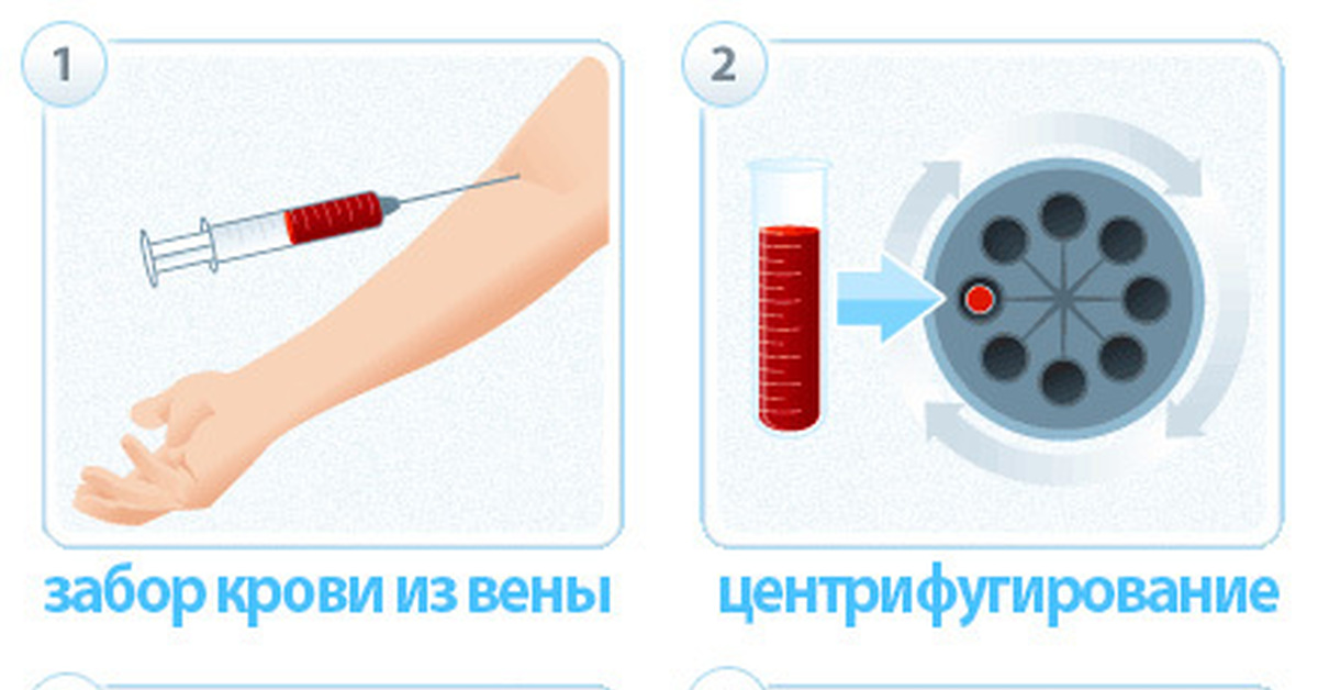Prp терапия плазма. Плазмолифтинг (1 пробирка). Prp-терапию (плазма обогащенная тромбоцитами). Prp-терапия (platelet rich plasma). Плазмолифтинг prp терапия.
