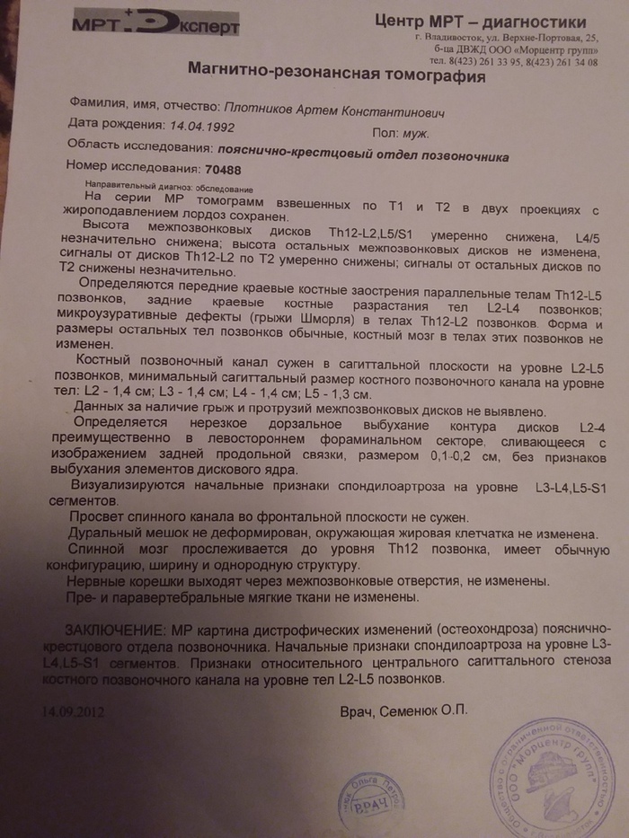 Помогите понять результат мрт спины | Пикабу