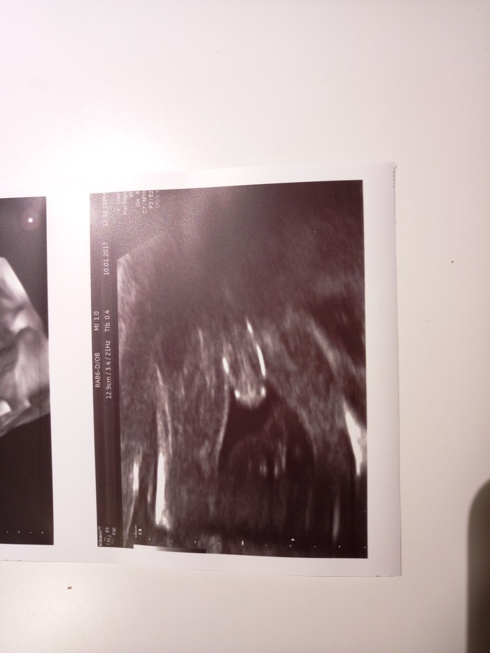 Как я понял, что у меня будет Сын