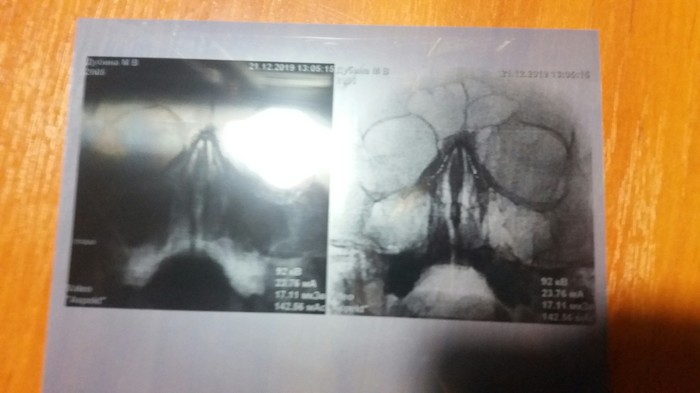 Про голос. Часть 2