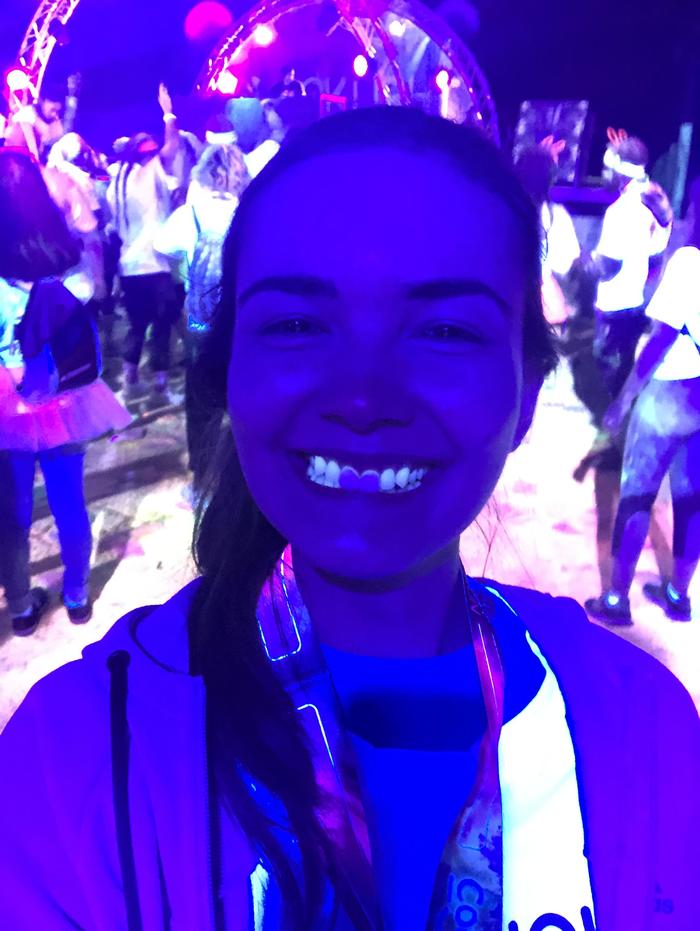 На заметку обладателям виниров