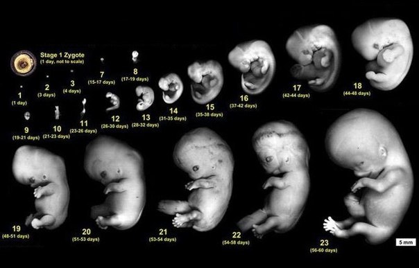 Эмбрион - человек или нет? | Пикабу