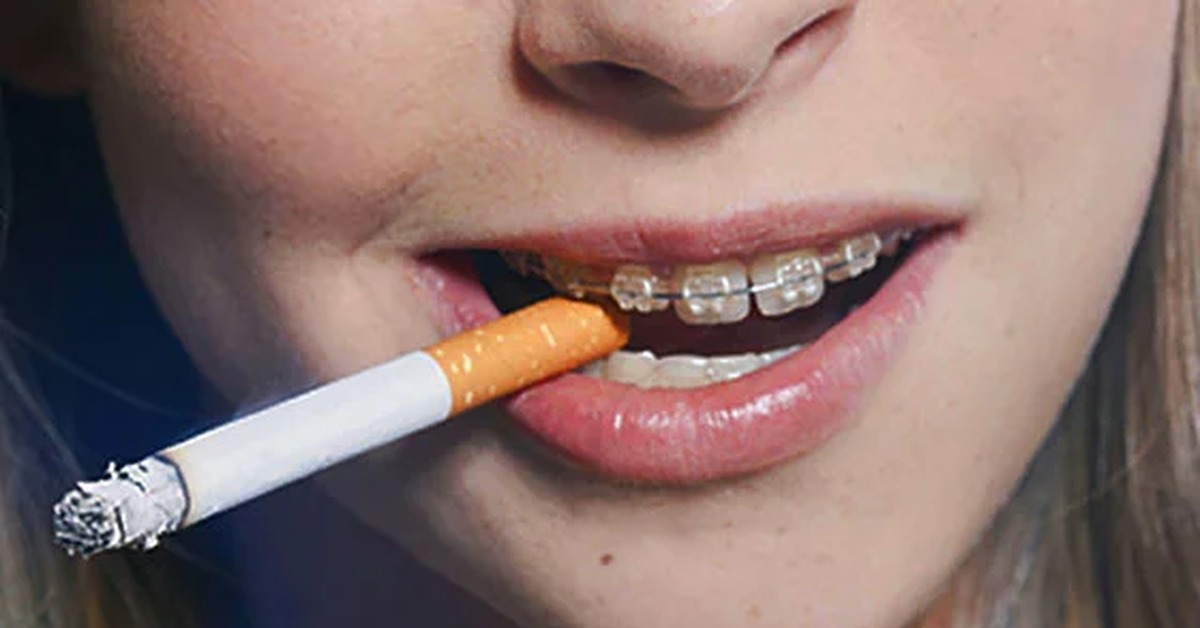 Почему нельзя курить после губ. Сигара в зубах.