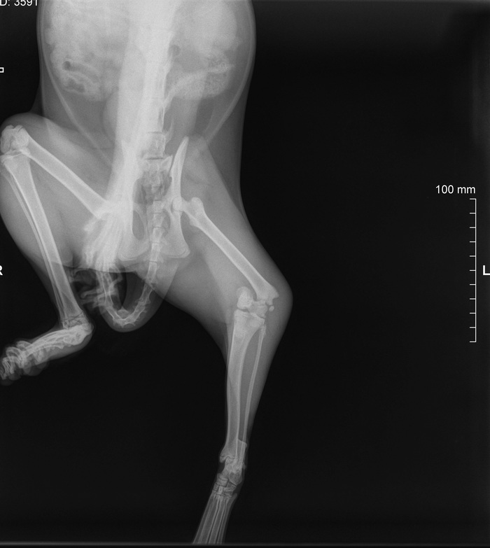 Гипс? Операция? Импланты? Помогите советом, пожалуйста!