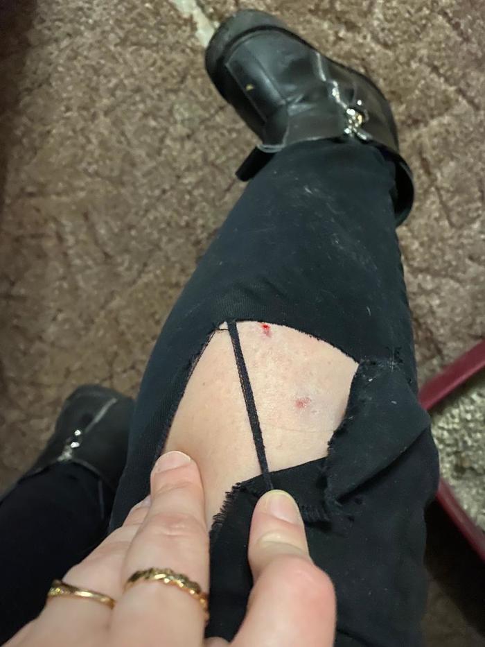 Накипело, собачники