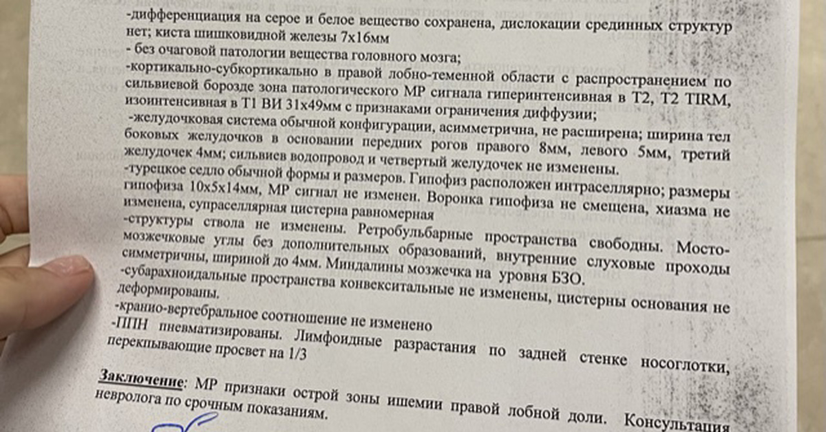 Инсульт история болезни по неврологии. Выписка из истории болезни инсульт. Эпикриз больного с ишемическим инсультом. Выписка из истории болезни ишемический инсульт. История болезни ишемический инсульт.