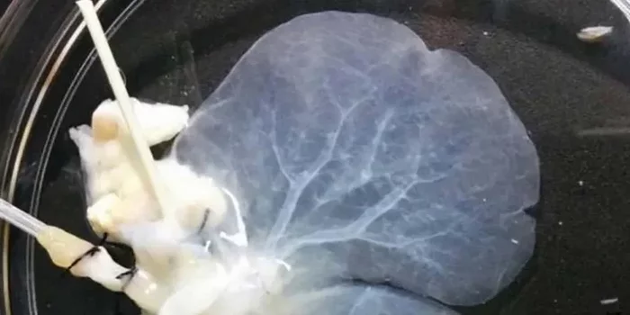 Создана технология выращивания неотторгаемой печени для пересадки Медицина, Печень, Органы, Умершие, Труп, Наука, Копипаста Создана технология выращивания неотторгаемой печени для пересадки Медицина, Печень, Органы, Умершие, Труп, Наука, Копипаста