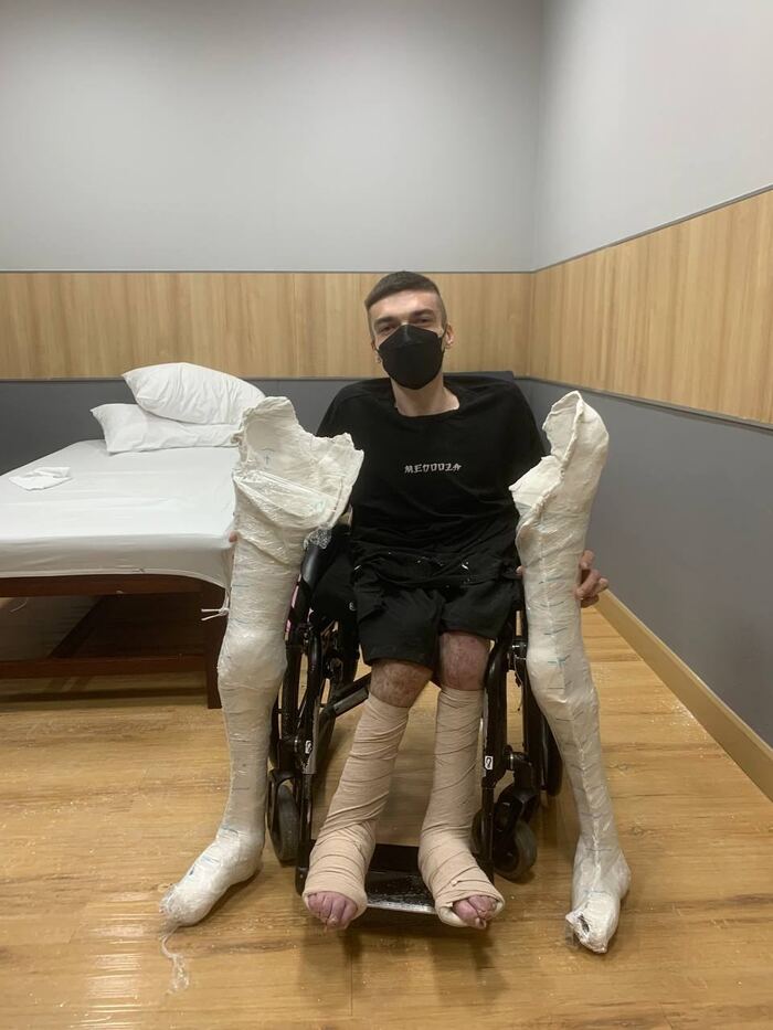 На подходе новые ноги | Пикабу