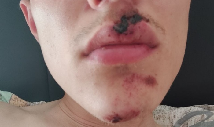 Попал в аварию, а Яндекс послал курьера Работа, Яндекс, Обман, Развод на деньги, Обман клиентов, Клиенты, Жалоба, Жадность, Мошенничество, Служба поддержки, Маркетплейс, Бесит, Авария, Длиннопост, Негатив