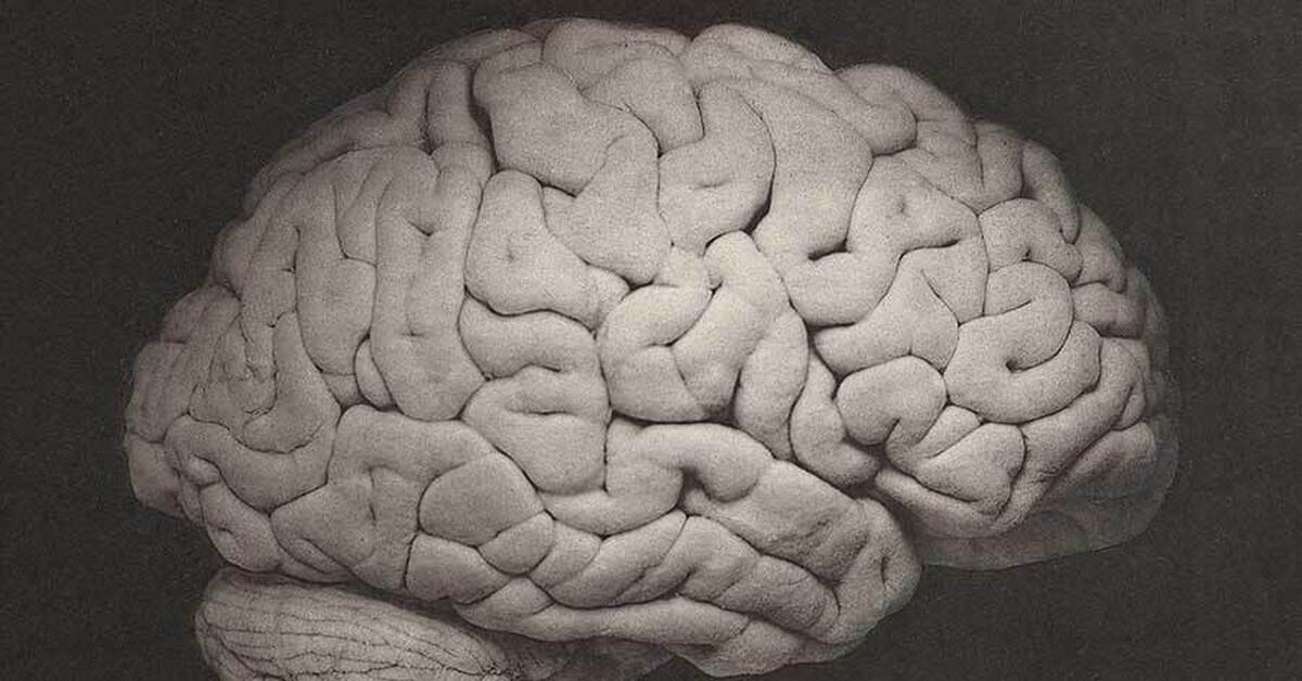 Brain and some. Огромные мозги человека.