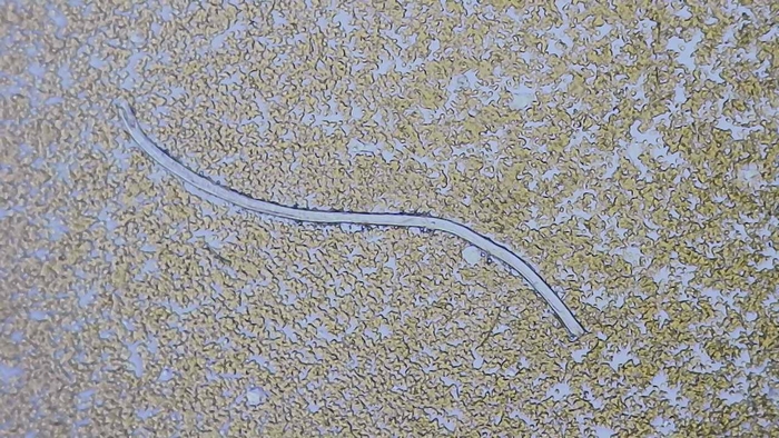 Что за полоски в крови