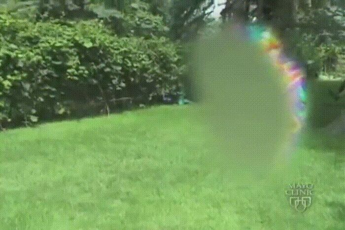 Хроническая мигрень. Как лечить и почему сосудистые и ноотропы никогда не помогут?