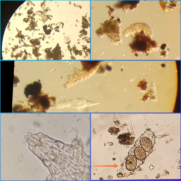 Кого зимой изучать под Микроскопом? Тихоходок! Микроскоп, Тихоходка, Биология, Видео, Вертикальное видео, Длиннопост