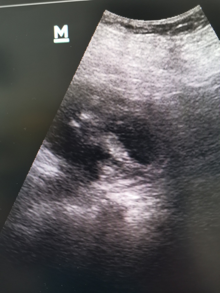 Будни приёмника