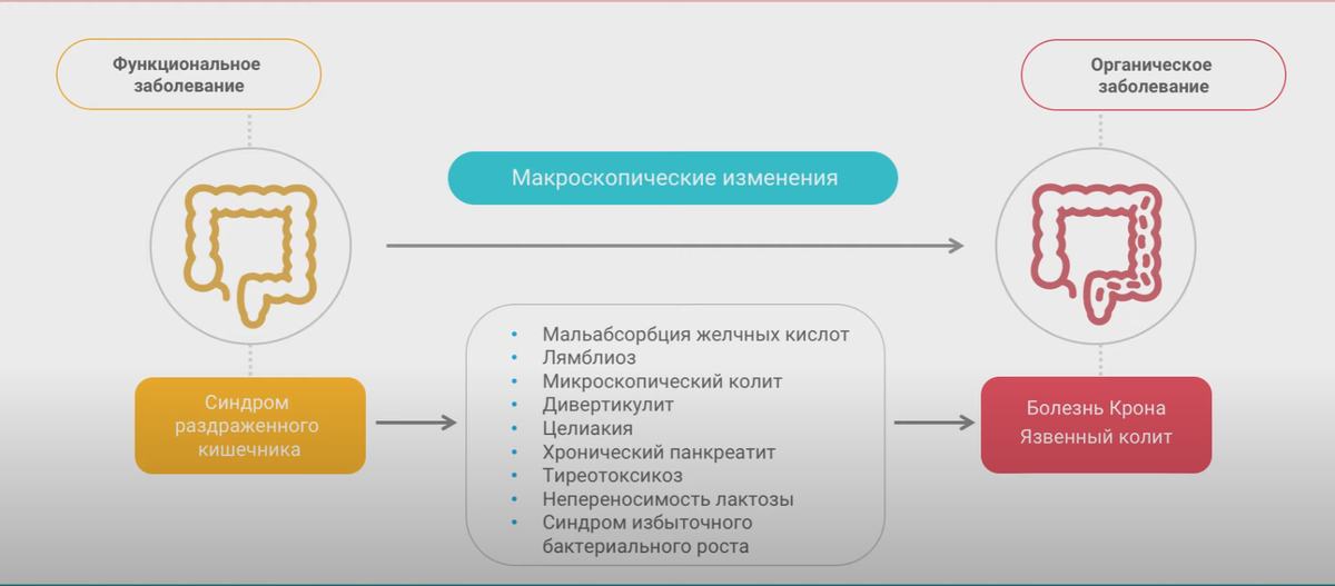 Как лечить сибр кишечника схема лечения взрослым. Схема лечения сибр нутрициологами. сибр в кишечнике как определить. синдром избыточного бактериального роста вызывающий запор с, s, m l.