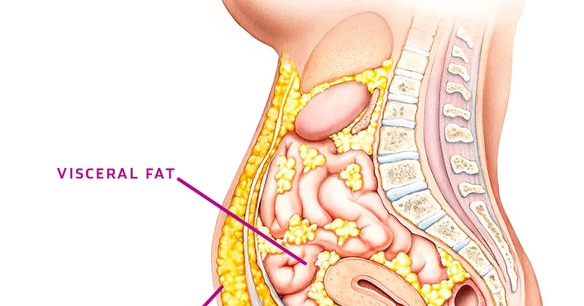 Висцелярный жир фото