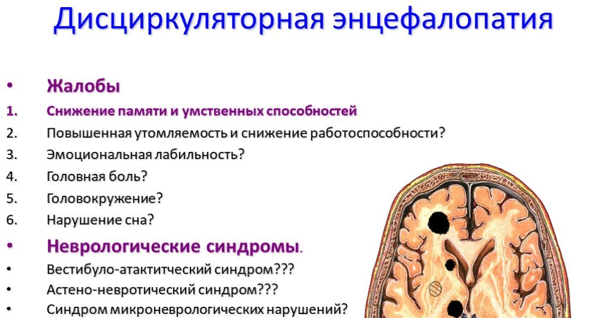 Цвб дэ. Дисциркуляторная энцефалопатия головного мозга. Признаки дисциркуляторной энцефалопатии. Энцефалопатия клинические проявления. Хроническая дисциркуляторная энцефалопатия симптомы.