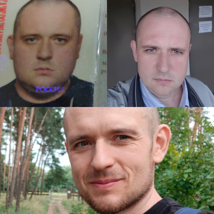 Внешний вид после кето