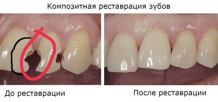 Помогите с хорошим стоматологом в Ташкенте! Без рейтинга, Стоматология, Помогите найти, Сила Пикабу, Нужен совет, Консультация