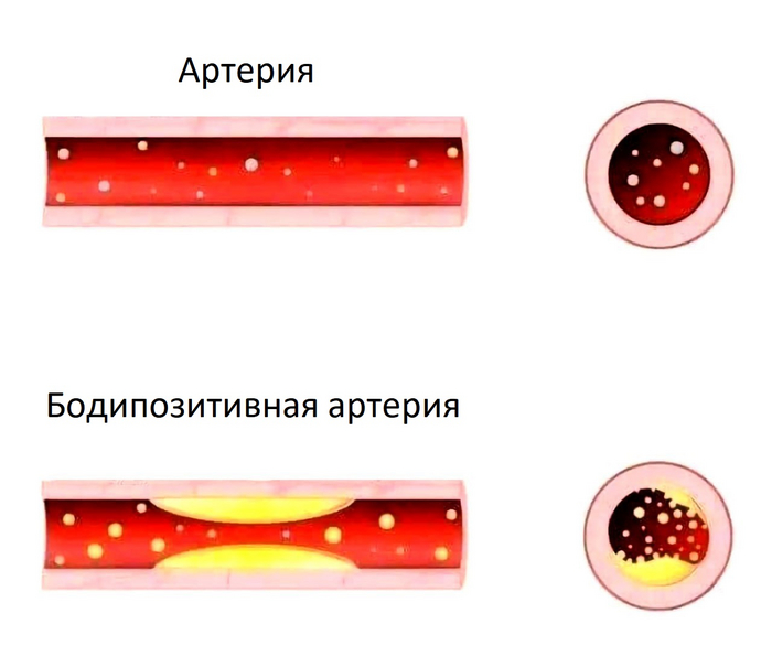 Принимай такой, какая она есть