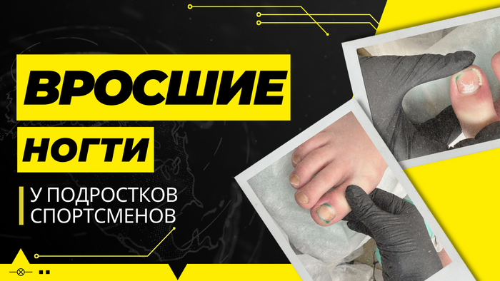 ������� ����� � ���������� �����������