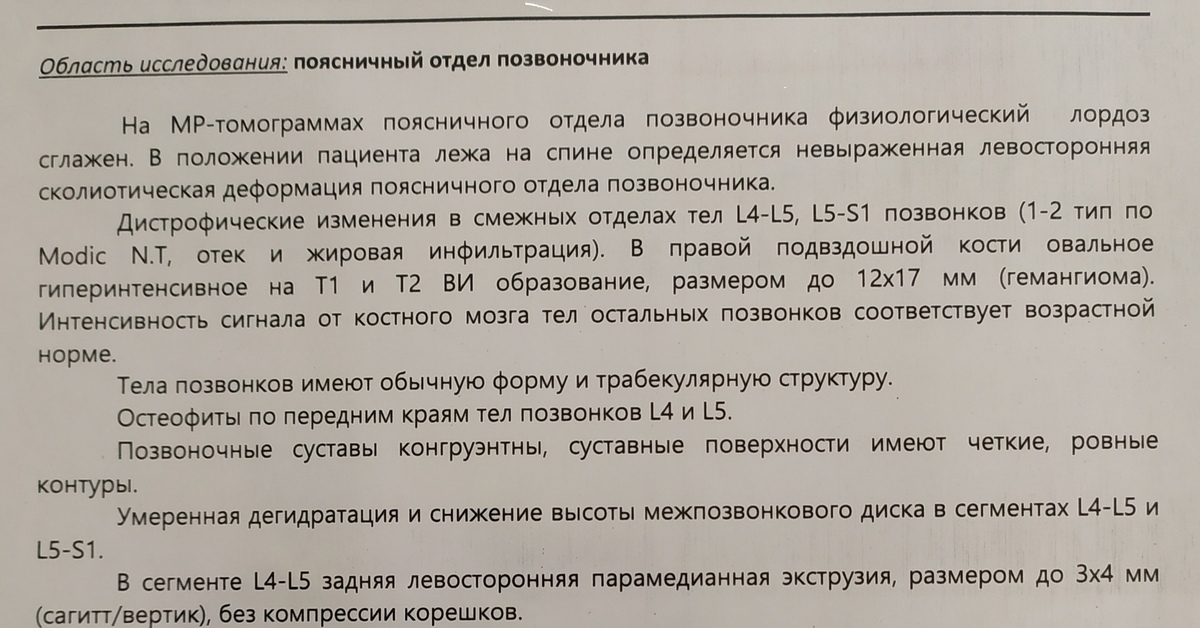 МРТ поясничного отдела позвоночника | Пикабу