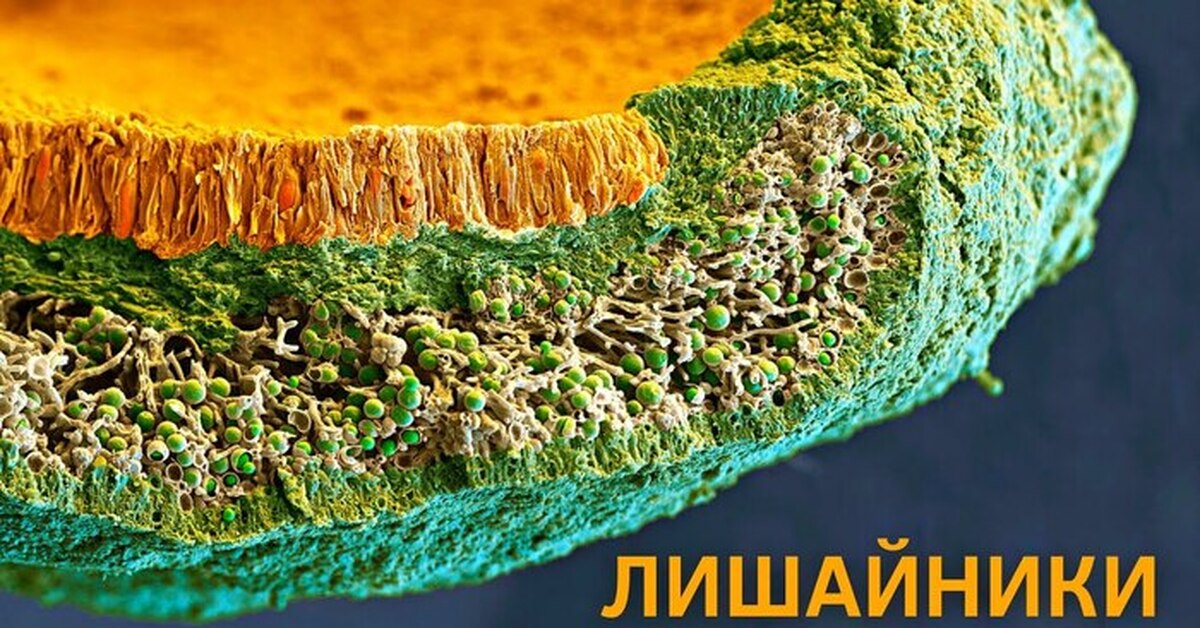 Микроскопом лишайник. Лишайники симбионты. Поперечный срез лишайника под микроскопом. Лишайник микроскоп. Строение лишайника под микроскопом.
