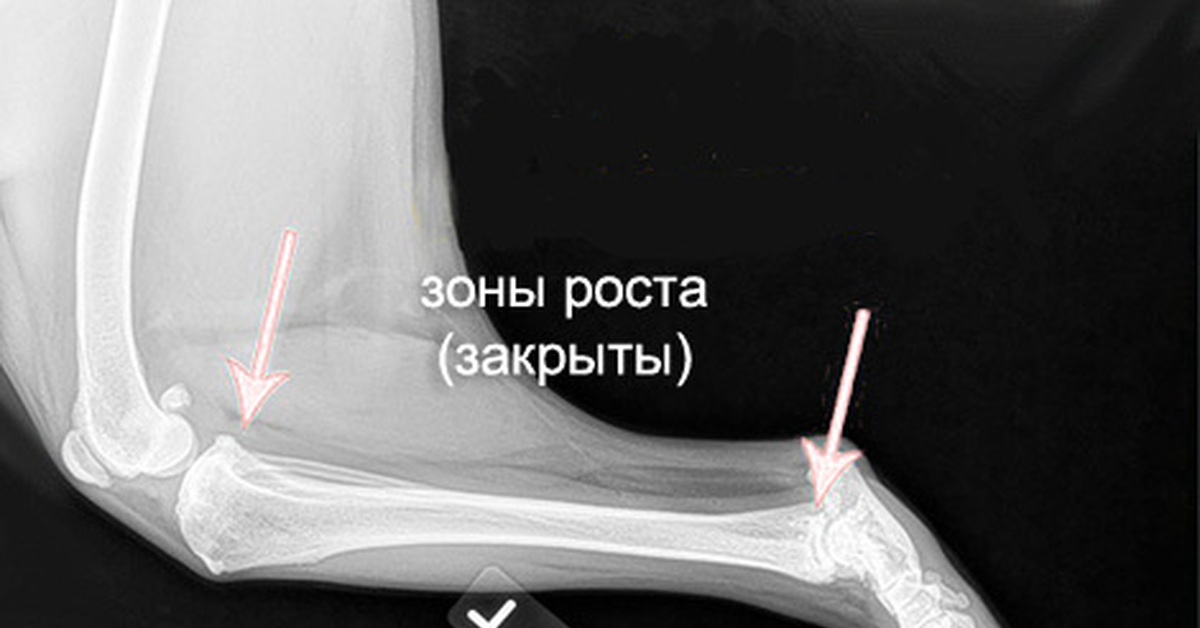 Зона роста кости. Закрытие зон роста костей у собак.