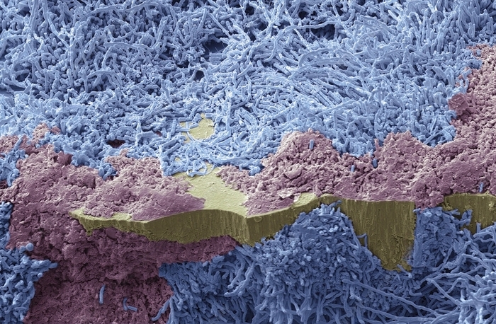 Биоплёнки под микроскопом Микроскоп, Биология, Научпоп, Исследования, Наука, Длиннопост