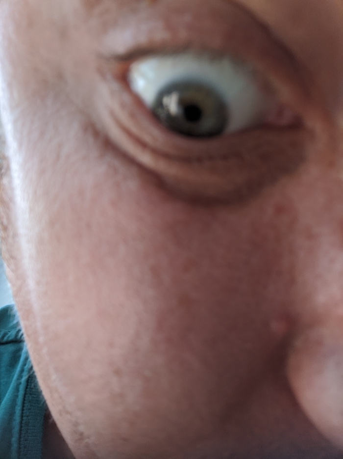 Тут лайкают за красивые глаза вот вам не красивый глаз!