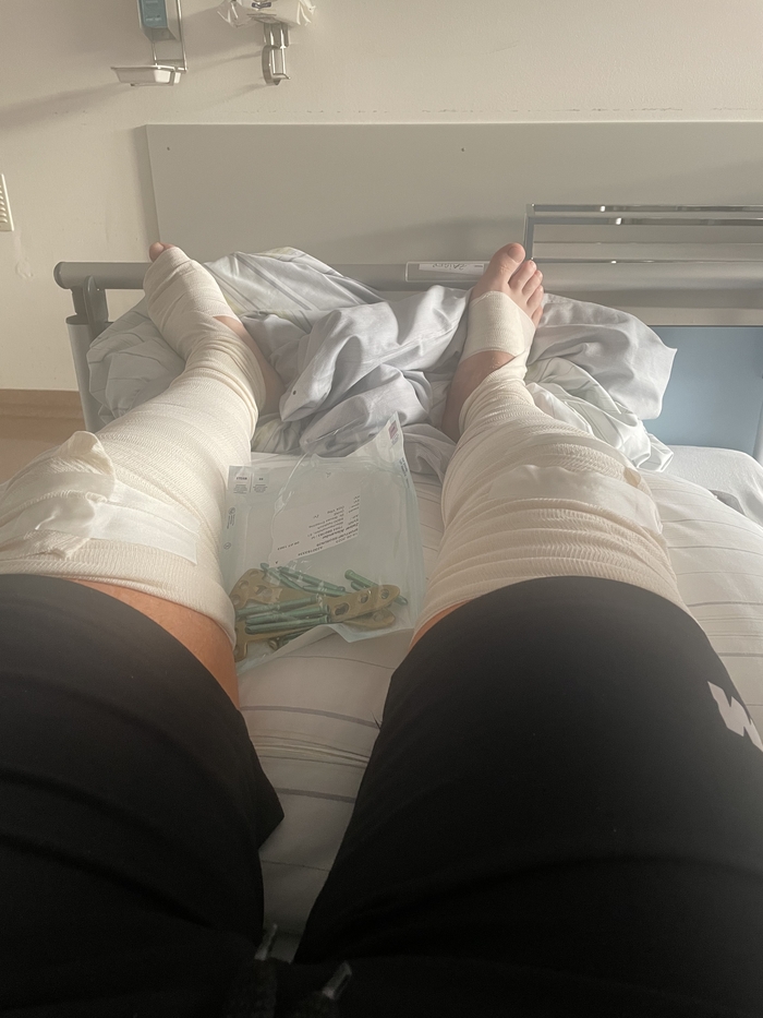 Операция по удалению шурупов прошла успешно | Пикабу