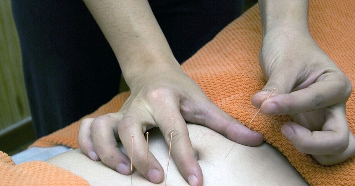 Причины покалывания в ногах. Колет ногу как иголками причины. Колет ногу как иголками причины. Колет ногу как иголками причины. Акупунктура в физиотерапии.