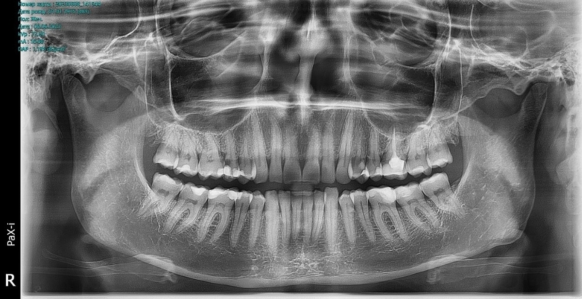 Посоветуйте стоматолога в Москве! | Пикабу