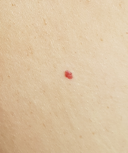 Стоит ли бить тревогу?