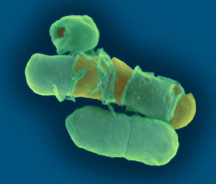 Влияние антибиотика на бактерий под микроскопом