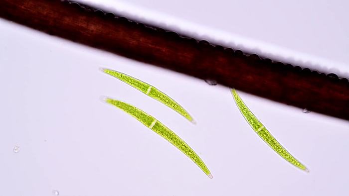 Десмидиевые водоросли (Клостериум) на фоне человеческого волоса